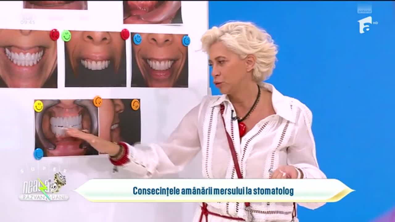 Super Neatza, 3 iulie 2025. Consecințele amânării mersului la stomatolog